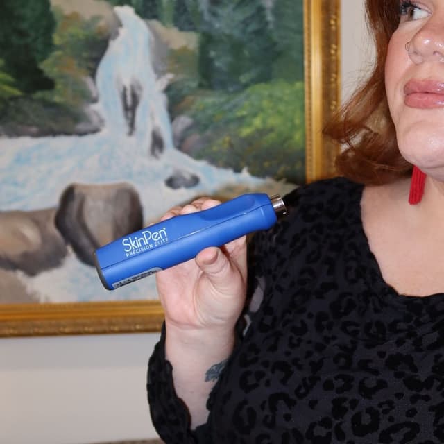 SkinPen Microneedling 3 Sessions